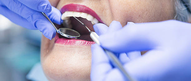 Best Broken or Cracked Tooth Emergency Dentist in Lodi, OH